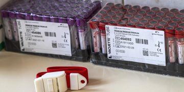 epa08297910 Test tubes prepared for blood samples in a ward set up for receiving new patents infected with the Covid-19 virus in a hospital in Budapest, Hungary, 16 March 2020. The number of people in Hungary testing positive for the new coronavirus has increased to 39, and one person has died.  EPA-EFE/ZSOLT SZIGETVARY HUNGARY OUT